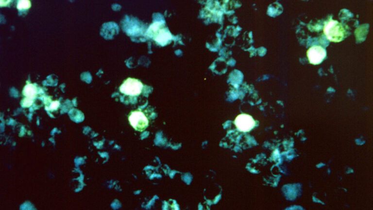 New study untangles how Epstein-Barr virus triggers immune response in MS