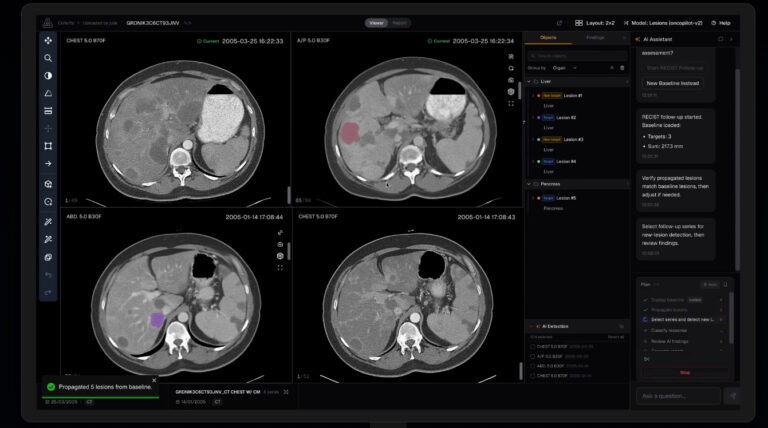 Raidium Launches AI-Native Radiology Platform Across US Cancer Centers